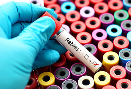 Rabies test