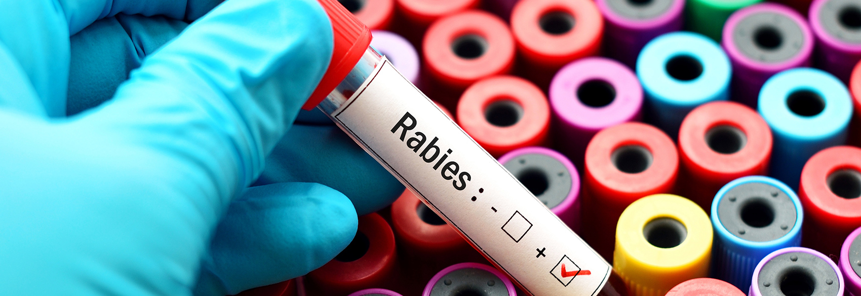 Rabies test