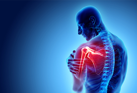 Shoulder Musculoskeletal System